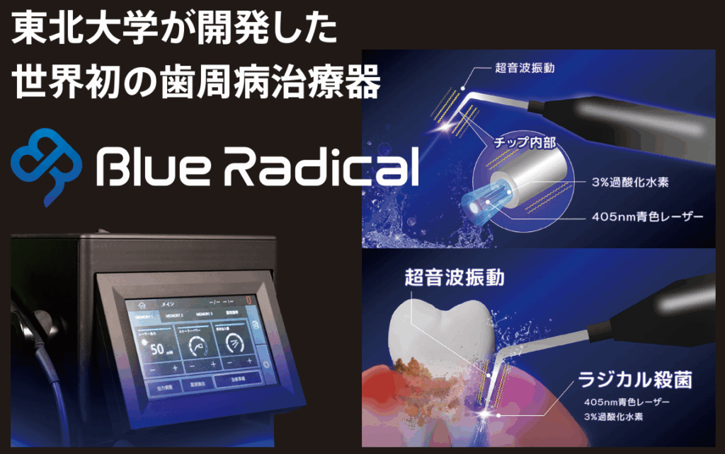 ブルーラジカル2｜自由が丘駅前歯医者