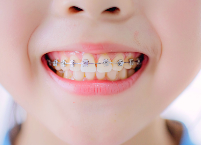 きれいな歯並びはお子様の健やかな未来を育む大切な「贈り物」|自由が丘駅前歯医者