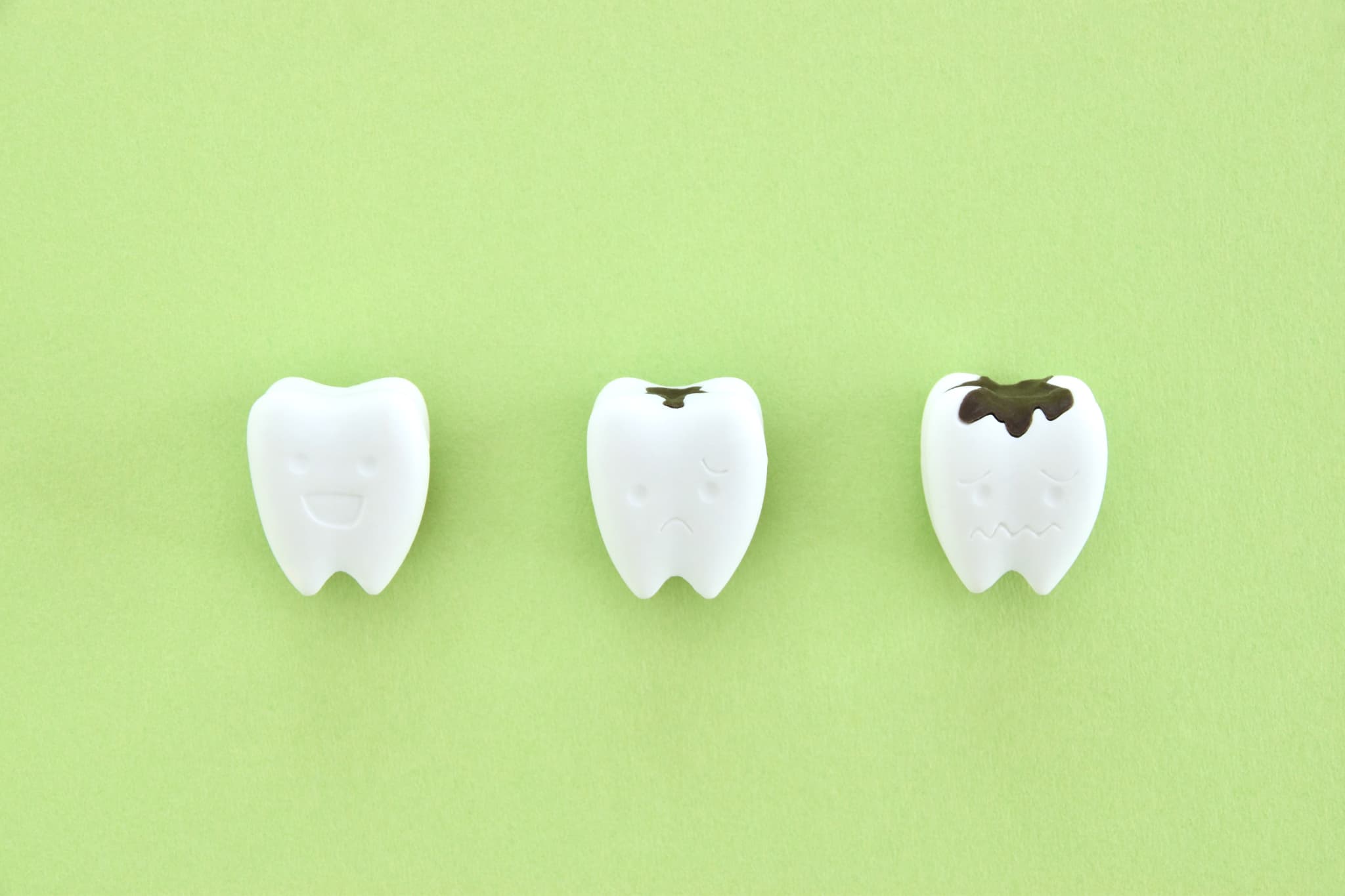 虫歯が進行していくイメージ