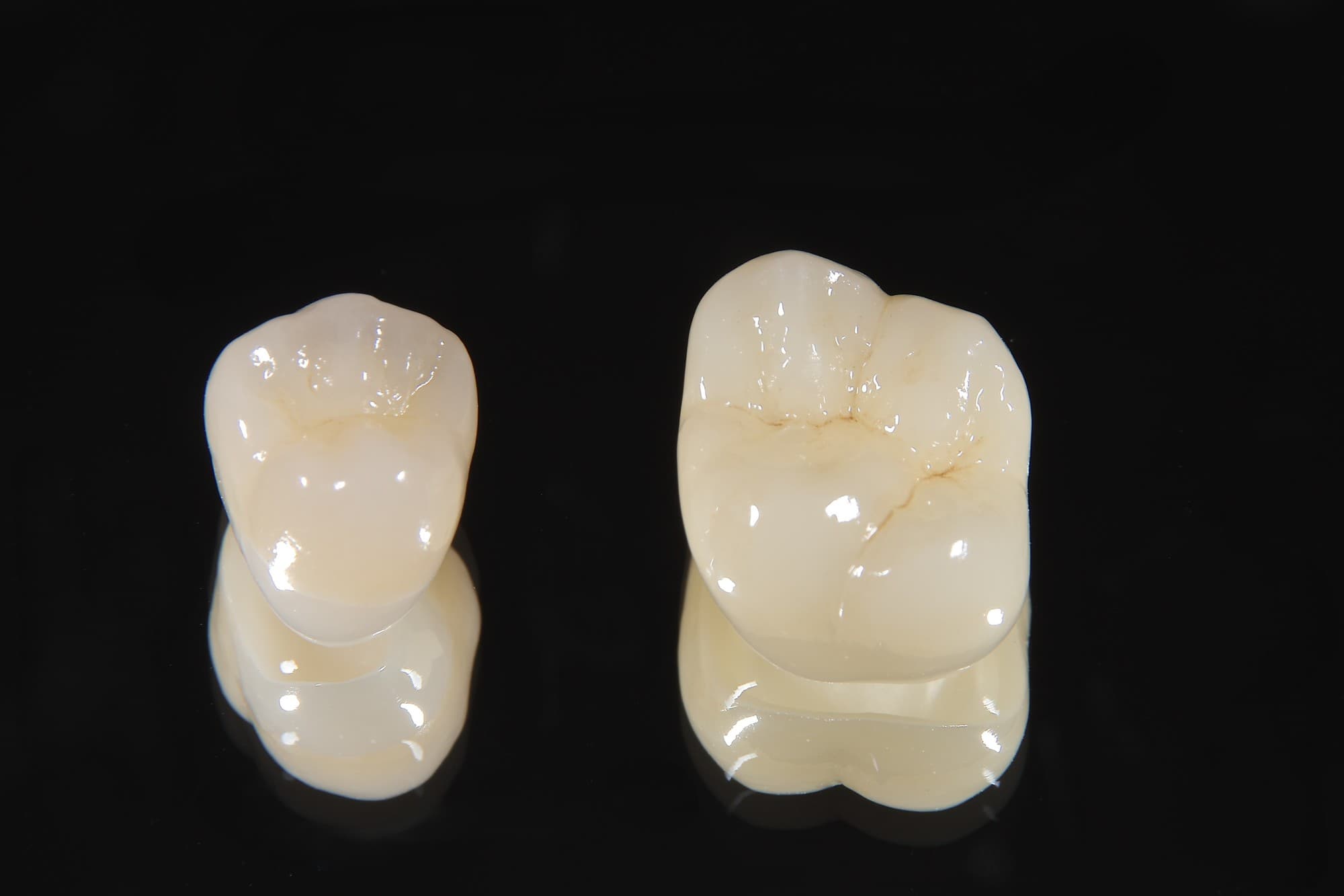 セラミックの小臼歯と臼歯