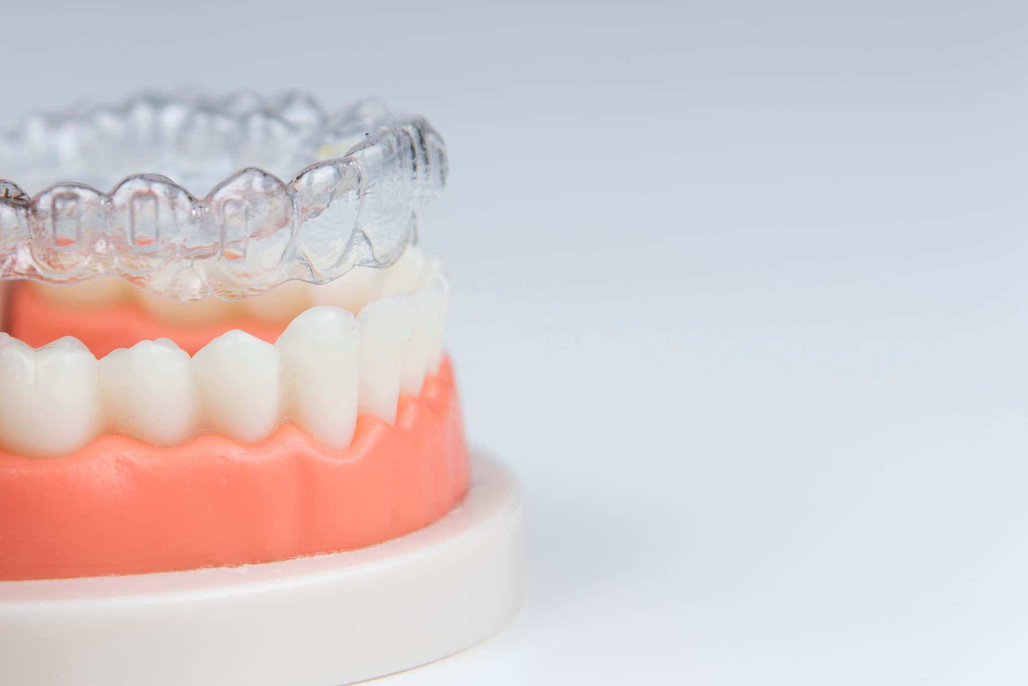 マウスピースと歯の模型